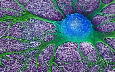 A growing mouse neural stem cell